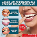 [PAGA 1 y LLEVA 2] CARILLAS DENTALES AJUSTABLES - SNAP-ON SMILE